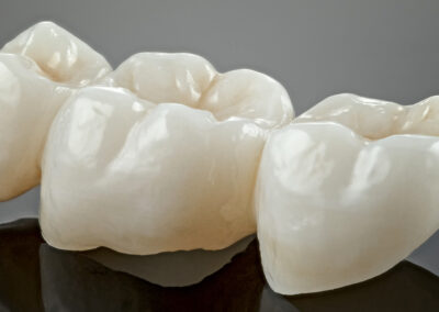 Metal free ceramic dental crowns