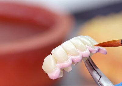 Zirconium porcelain and implant studies in the Dental Laboratory